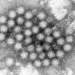 Norovirus Outbreaks Surge: What You Need to Know This Winter