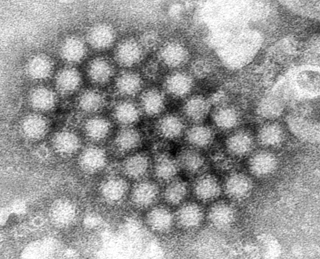 Norovirus Outbreaks Surge: What You Need to Know This Winter